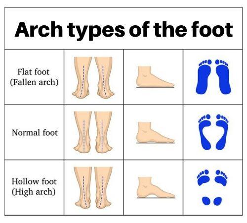 arch types of runner's feet